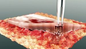 Haemostatic Compress