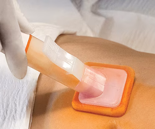 Skin Prep and Irrigation